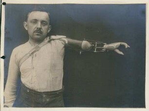 Foto eines am linken Arm Amputierten mit auf Schulterhöhe gestreckter Armprothese im Kngl. Reservelazarett in Singen