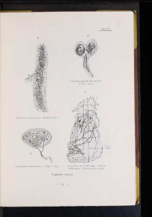 36. Genitalnervenkörperchen. (Dogiel 1893).