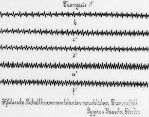 Köhlersche Schallkurven, Trompete 1 : Technikgeschichte | Physik | Akustik | Schallschwingungen und ihre photographische Wiedergabe
