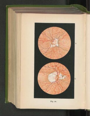 Fig. 86. Hintere Vortexvenen.