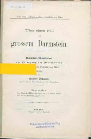 Über einen Fall von grossem Darmstein