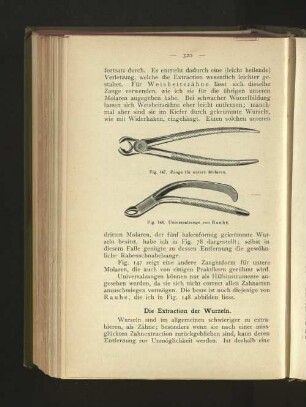 Die Extraction der Wurzeln.