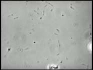 Mycoplasma pneumoniae (Mycoplasmataceae) - Bewegung, Vermehrung und Koloniebildung