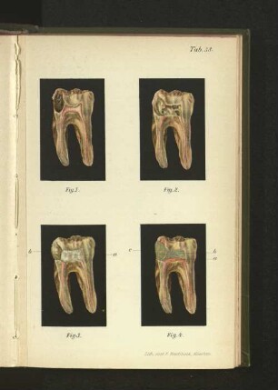 Tab. 38.