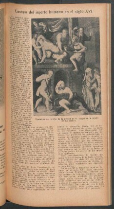 Ensayo del injerto humano en el siglo XVI