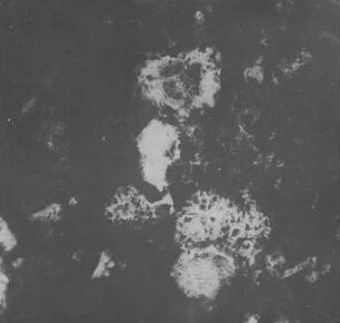 Sporen- und Bitumenzusammenballungen (Jeffrey) : Geologie | Kohlengeologie | Das mikroskopische Bild der Kohle (Mikroskopische Kohlenpetrographie)