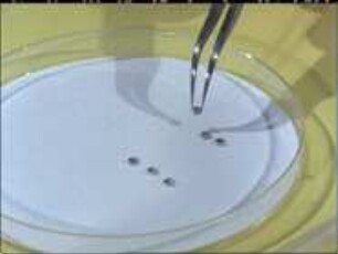 Electron Microscopic Preparation Techniques - 5. Spreading Technique for Preparing Isolated DNA