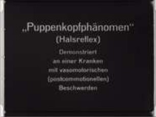 Puppenkopf-Phänomen