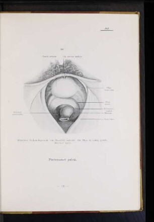 Peritonaeum pelvis.