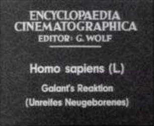 Homo sapiens - Galants Reaktion (Unreifes Neugeborenes)
