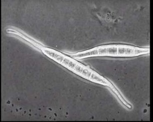 Dermatophyten - Asexuelle Vermehrung bei Microsporum canis