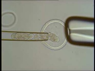 Biotechnik in der Fortpflanzung - Mikromanipulation an Eizellen und Embryonen der Maus