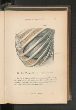 Fig. 316. Topographie einer vergrösserten Milz.