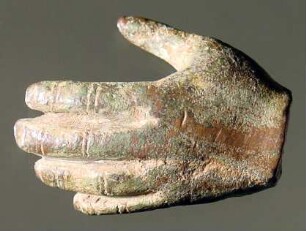 Abgebrochene linke Hand