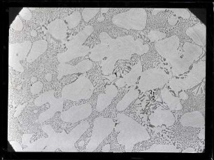 Mikrofotografie: Aluminium-Magnesium-Gusslegierung