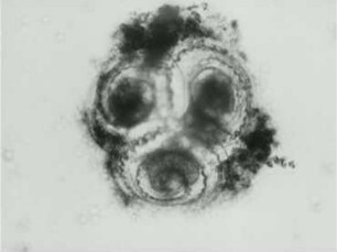 Patellina corrugata (Foraminifera) - Fortpflanzung