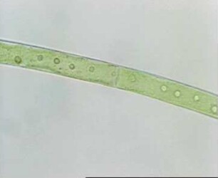 Chloroplastenbewegung - Mougeotia spec.