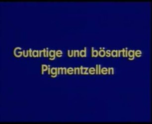 Gutartige und bösartige Pigmentzellen