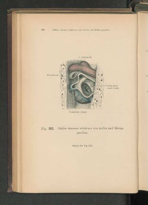 Fig. 262. Ostium venosum sinistrum von rechts und hinten gesehen.