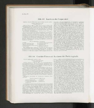 Abb. 163 Karzinom des Corpus uteri