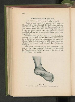 Fig. 90. Enucleatio pedis sub talo. Hautschnitt.