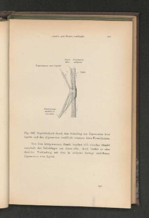 Fig. 545. Sagittalschnitt durch den Nabelring das Ligamentum teres hepatis und das Ligamentum umbilicale commune eines Erwachsenen.