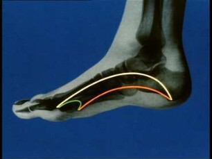 Orthopädische Krankenuntersuchung - Fuß