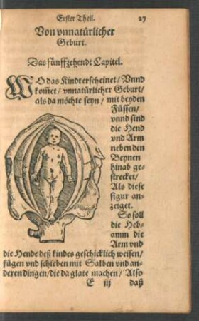 Von unnatürlicher Geburt. Das fünffzehendt Capitel.