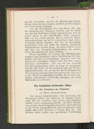 Die Extraktion bleibender Zähne.