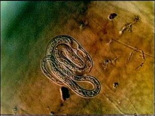 Parasit-Wirt-Beziehungen zwischen dem Nematoden Hydromermis contorta und der Zuckmücke Chironomus thummi