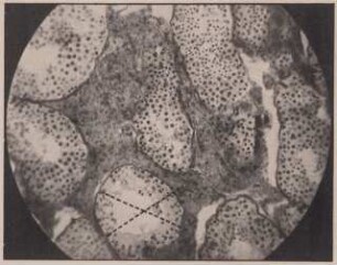 Abbildung eines Mikrophotogramms von einem Hoden
