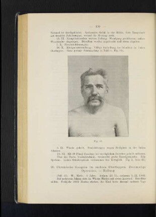 Fig. 42.