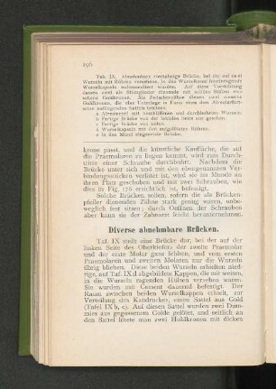 Diverse abnehmbare Brücken.