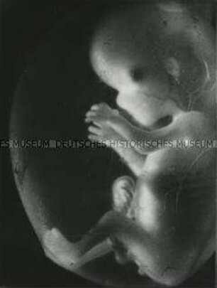 Menschlicher Fötus im Mutterleib