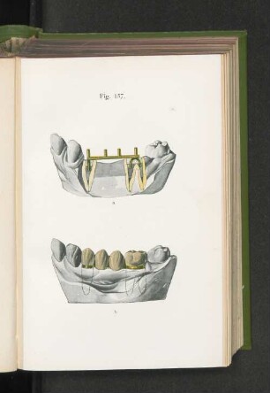 Fig. 157.