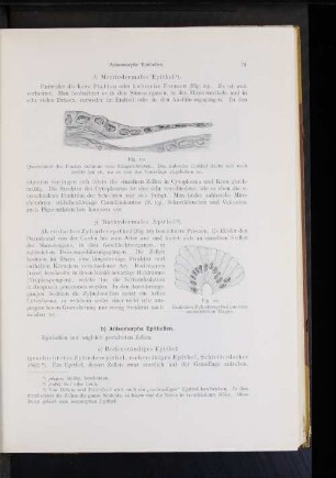 Metriodermales Epithel.