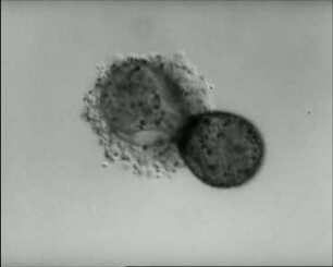 Difflugia oviformis (Testacea) - Bewegung und Fortpflanzung