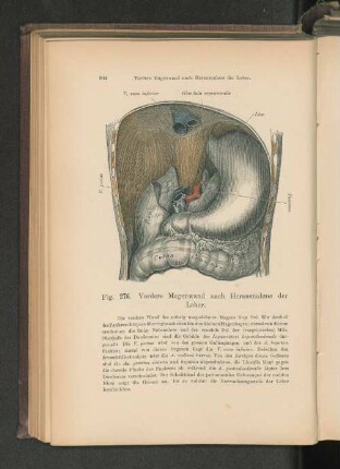 Fig. 276. Vordere Magenwand nach Herausnahme der Leber.
