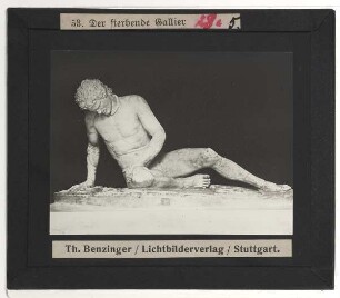 unbekannt, Sterbender Gallier