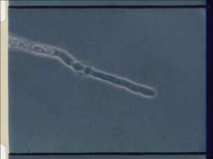 Infection of Nematodes by Hourglass Traps and Conidial Traps in Nematoctonus spp.