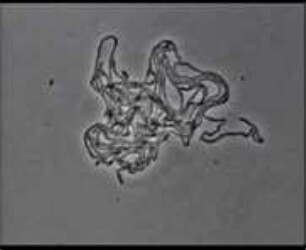 Streptobacillus moniliformis - Vermehrung und Koloniebildung