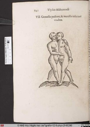 Gemellae pectore, & maxilla inferiori coalitae.