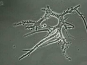 Form und Bewegung freilebender Amoeben