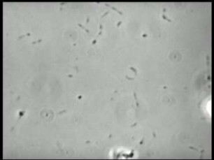 Mycoplasma pneumoniae (Mycoplasmataceae) - Bewegung, Vermehrung und Koloniebildung