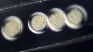 Egg sac, undet. taxon, Lazarote 2019