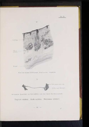 Organon auditus. Auris externa. Membrana tympani.