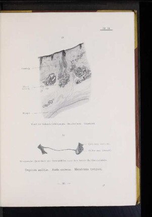 Organon auditus. Auris externa. Membrana tympani.