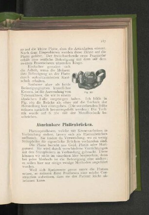 Abnehmbare Plattenbrücken.