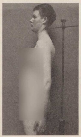 Fotografie eines unbekleideten Mannes (2)