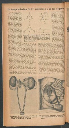La transplantación de los miembros y de los órganos